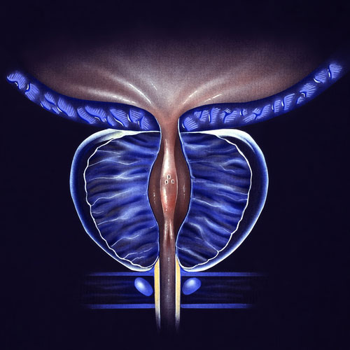 The image displays a detailed medical illustration of the human female reproductive system, focusing on the uterus and ovaries.