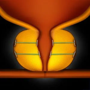 The image shows a humorous illustration of a basketball with two clothespins attached to it, positioned in such a way that they resemble a pair of legs or a humanoid figure.
